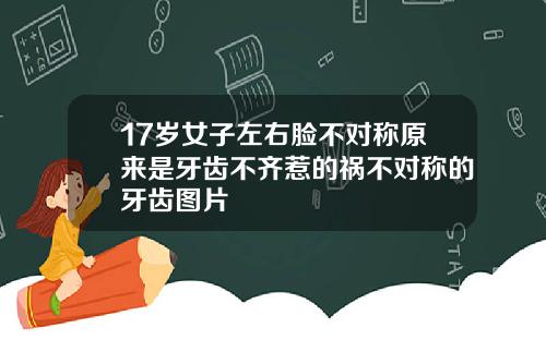 17岁女子左右脸不对称原来是牙齿不齐惹的祸不对称的牙齿图片
